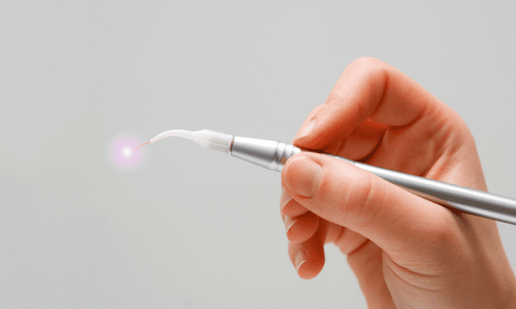 As technology continues to evolve, laser dentistry has become a trusted option in modern dental practices.