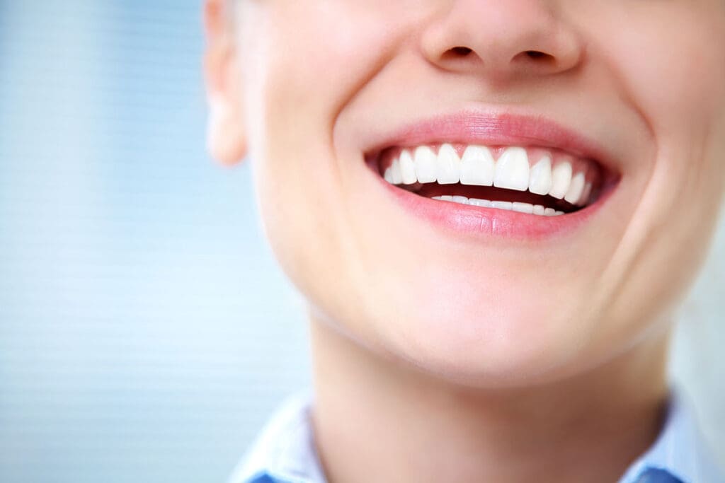 Discolored Teeth in Edmonton AB